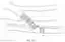 Fig. 20 - Endovascular implants and devices and methods for accurate placement