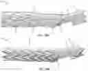 Fig. 25 - Endovascular implants and devices and methods for accurate placement