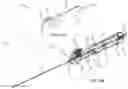 Fig. 29 - Endovascular implants and devices and methods for accurate placement
