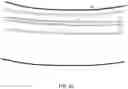 Fig. 32 - Endovascular implants and devices and methods for accurate placement