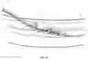 Fig. 41 - Endovascular implants and devices and methods for accurate placement