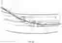 Fig. 42 - Endovascular implants and devices and methods for accurate placement