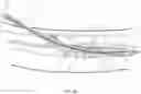 Fig. 44 - Endovascular implants and devices and methods for accurate placement