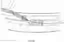 Fig. 45 - Endovascular implants and devices and methods for accurate placement