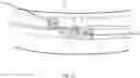 Fig. 46 - Endovascular implants and devices and methods for accurate placement