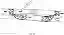 Fig. 48 - Endovascular implants and devices and methods for accurate placement
