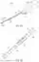 Fig. 04 - Dual lumen cannula and method of use