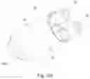 Fig. 12 - Dual lumen cannula and method of use