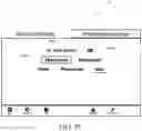 Fig. 81 - Fluid management systems and methods