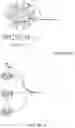 Fig. 33 - FLUSHING VAGINAL STENT DEVICES AND RELATED SYSTEMS AND METHODS
