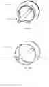 Fig. 35 - FLUSHING VAGINAL STENT DEVICES AND RELATED SYSTEMS AND METHODS