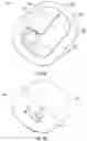 Fig. 02 - Remotely activated cannula insertion