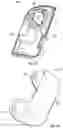 Fig. 04 - Remotely activated cannula insertion
