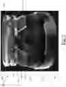Fig. 08 - Aerosol delivery device including a control body, an atomizer body, and a cartridge and related methods