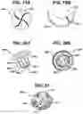 Fig. 22 - SURGICAL ACCESS DEVICE