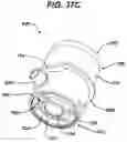 Fig. 45 - SURGICAL ACCESS DEVICE