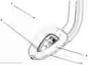 Fig. 01 - LARYNGEAL MASK
