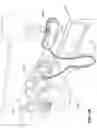 Fig. 02 - Patient interface