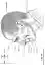 Fig. 08 - Patient interface