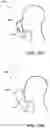 Fig. 16 - RESPIRATOR DEVICES WITH SOURCE CONTROL MECHANISMS AND ASSOCIATED SYSTEMS AND METHODS