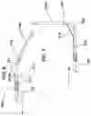 Fig. 06 - Devices for steering catheters