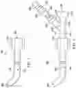 Fig. 02 - Apparatus, system and method for controlling the position of and providing suction in a surgical catheter or guide