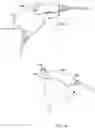 Fig. 04 - Apparatus, system and method for controlling the position of and providing suction in a surgical catheter or guide