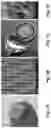Fig. 02 - VACCINATION USING HIGH-DENSITY MICROPROJECTION ARRAY PATCH