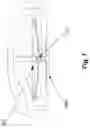 Fig. 06 - MICROPROJECTION ARRAY APPLICATOR AND METHOD