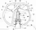 Fig. 01 - Heart pump with magnetic coupling and reverse flow