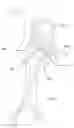 Fig. 07 - Conduit for Transseptal Passage to the Aorta