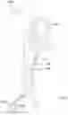 Fig. 09 - Conduit for Transseptal Passage to the Aorta