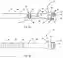 Fig. 03 - SYSTEM, METHOD, AND APPARATUS FOR APPLYING TRANSCUTANEOUS ELECTRICAL STIMULATION