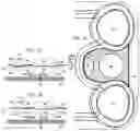 Fig. 08 - Stimulator for use with a mobile device