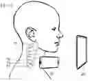 Fig. 11 - Stimulator for use with a mobile device
