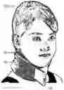 Fig. 12 - Stimulator for use with a mobile device
