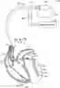 Fig. 01 - Method and device for avoiding competitive atrial pacing