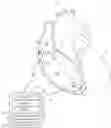 Fig. 01 - Medical device and method for determining atrioventricular synchrony