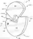 Fig. 01 - Weight modification clamp and method