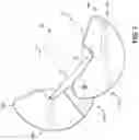 Fig. 05 - Weight modification clamp and method