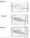 Fig. 07 - Method and device for casting a rotor of a compressor, vacuum pump and/or expander device with a longitudinal axis