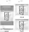Fig. 07 - Braces, method and process of use thereof for the repair of a storage rack