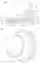 Fig. 04 - ANNULAR NOZZLE