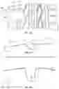 Fig. 50 - MESH REGISTRATION SYSTEM AND METHOD FOR DIAGNOSING TREAD WEAR