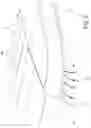 Fig. 09 - Rear corner element