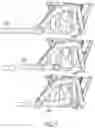 Fig. 11 - SEAT ASSEMBLY AND SYSTEMS
