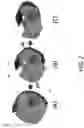 Fig. 03 - Reconfigurable wheel-track assembly with bowtie configuration