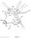 Fig. 17 - Anchor assist device