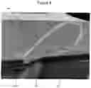 Fig. 09 - A CABLE TIE