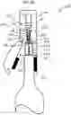Fig. 06 - Cork extractor